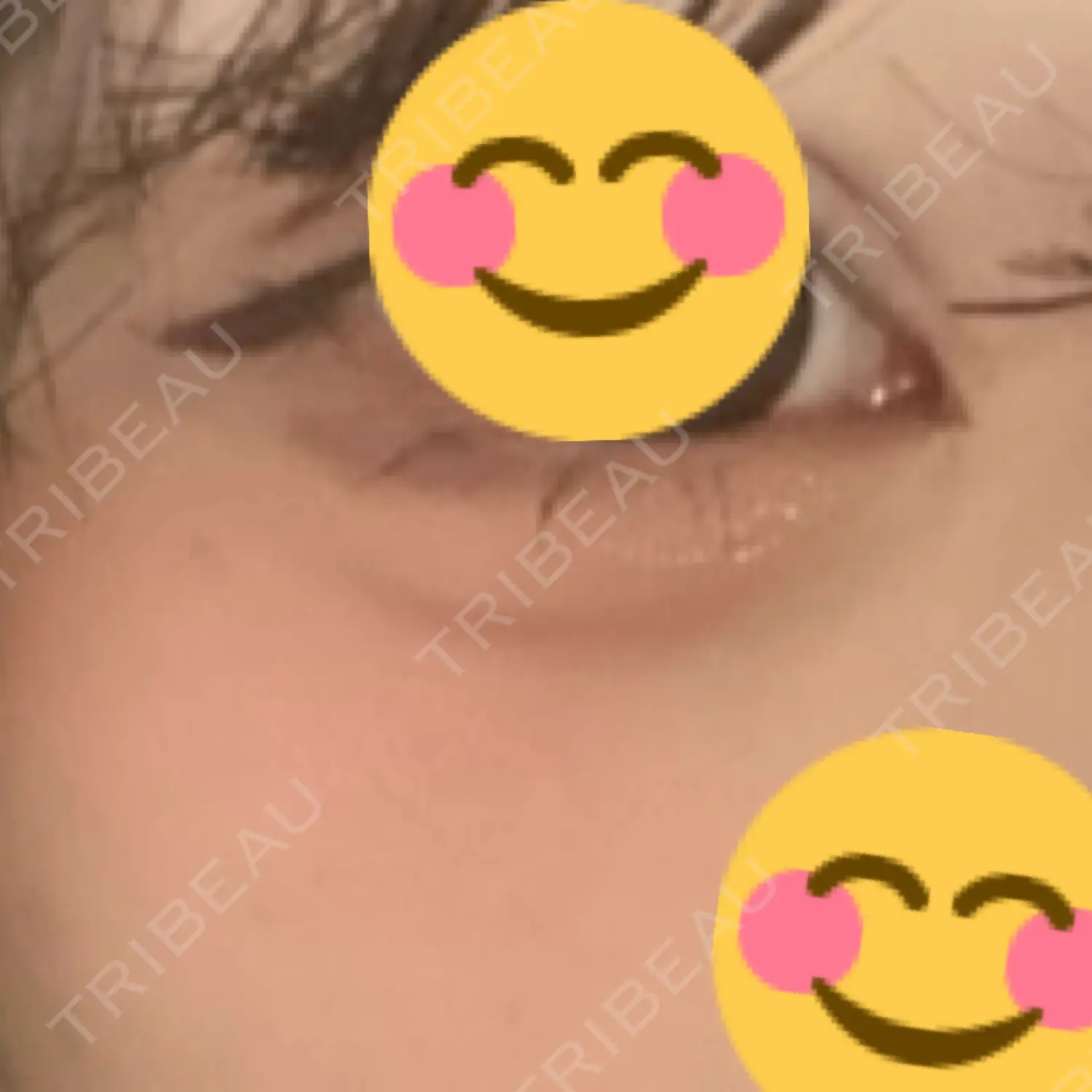 施術後の写真