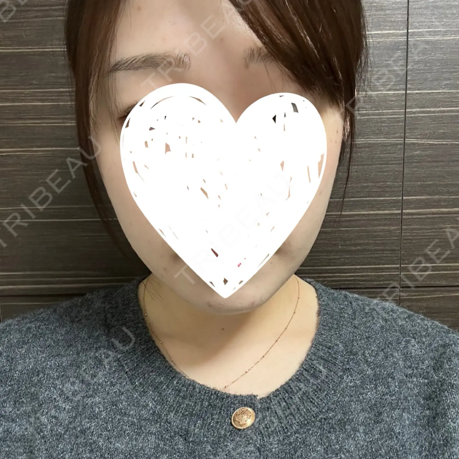 施術後の写真