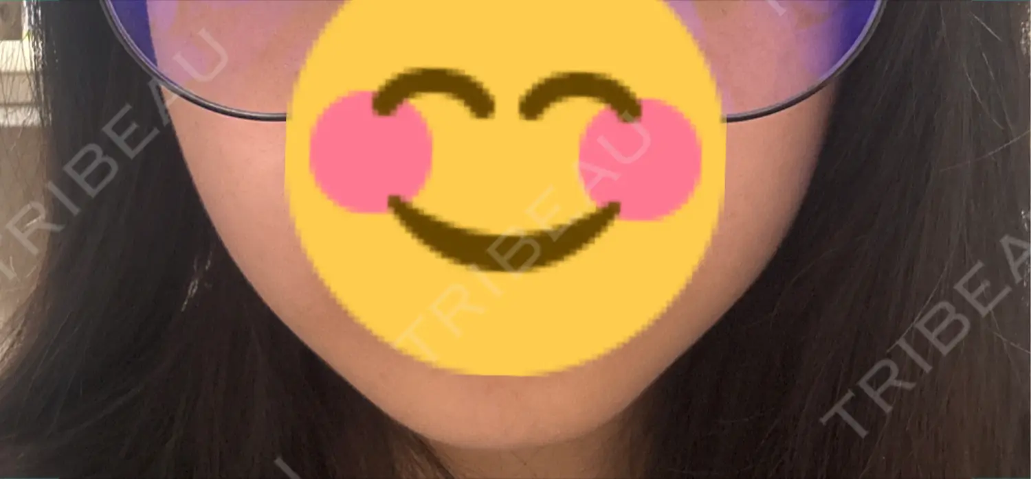 施術後の写真