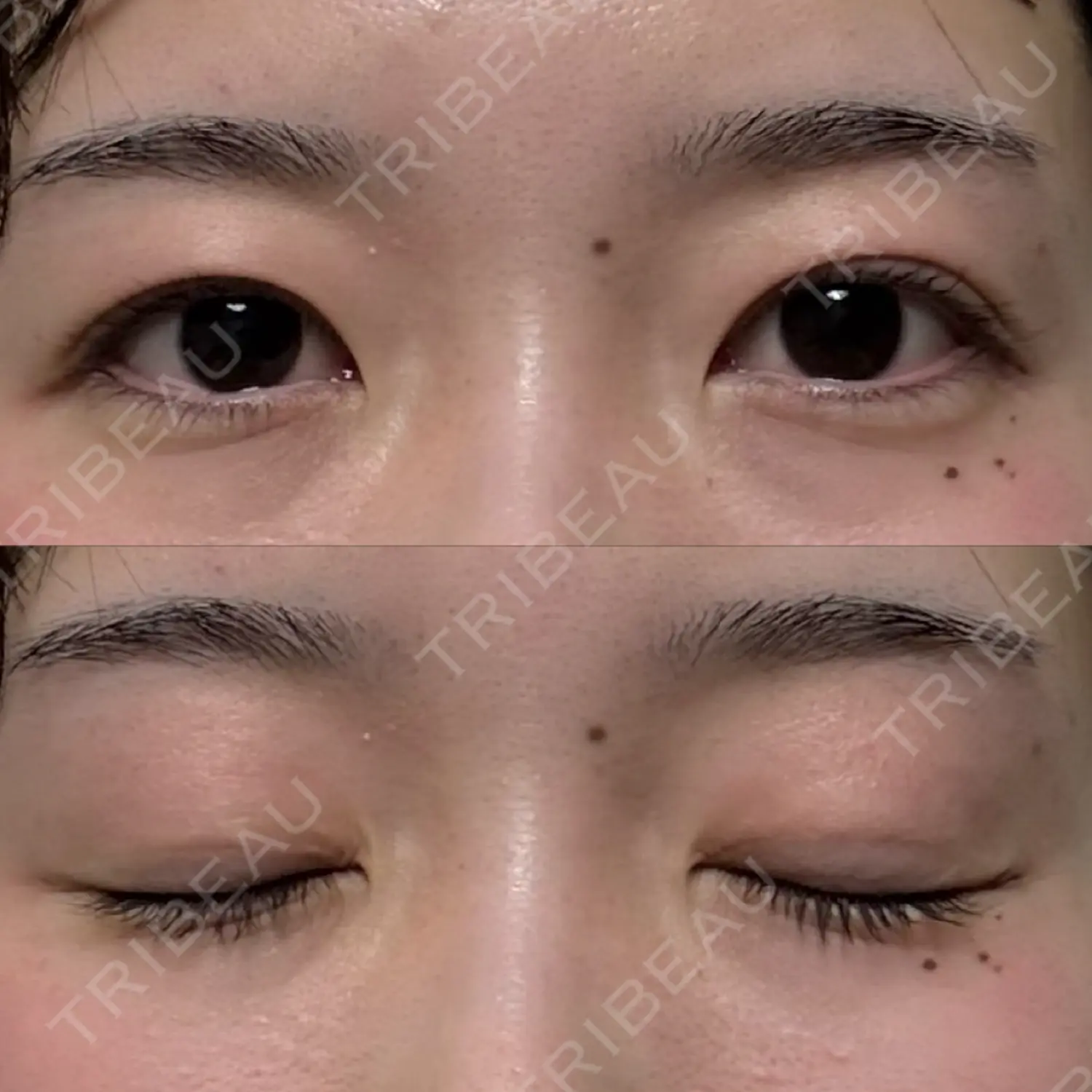施術後の写真