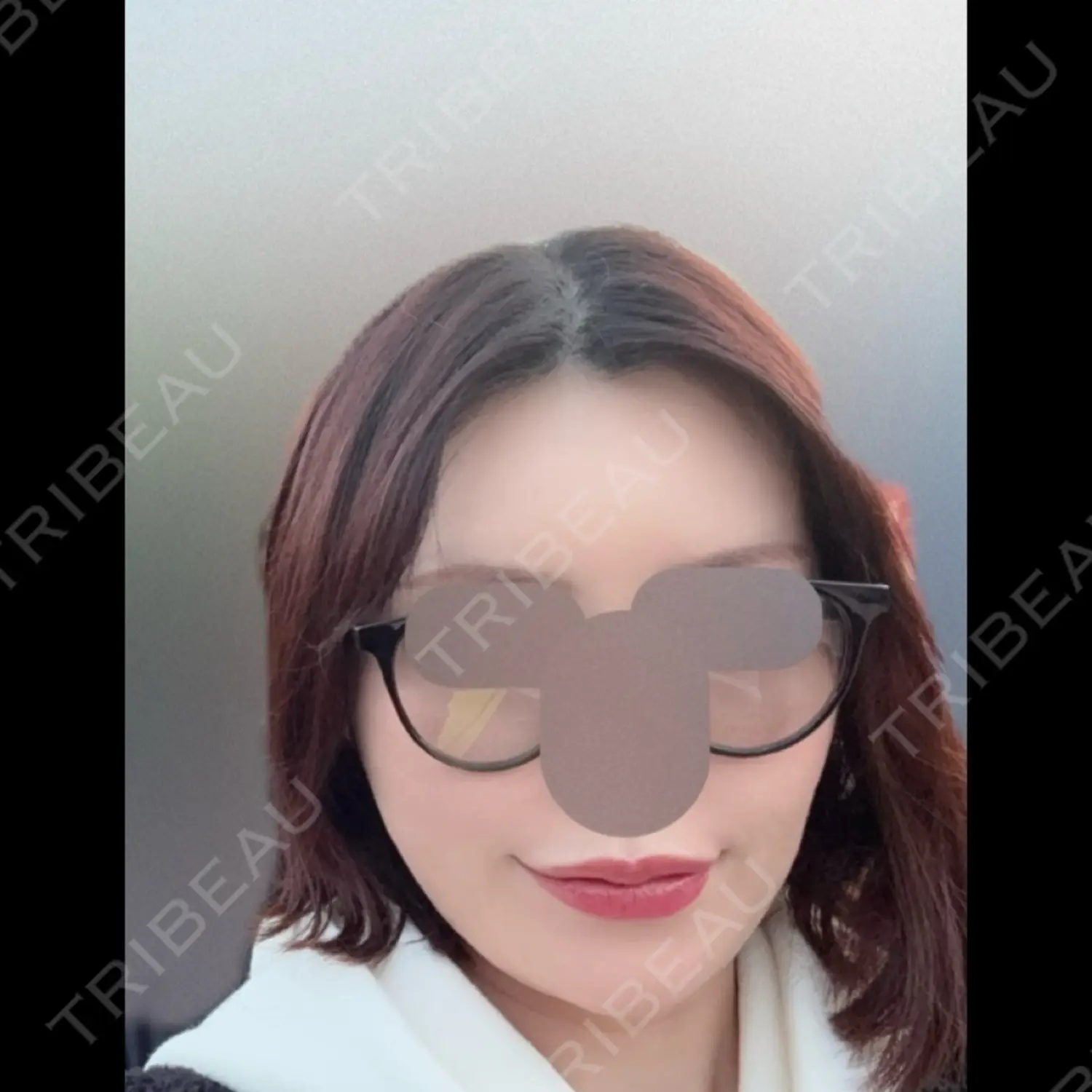 施術後の写真