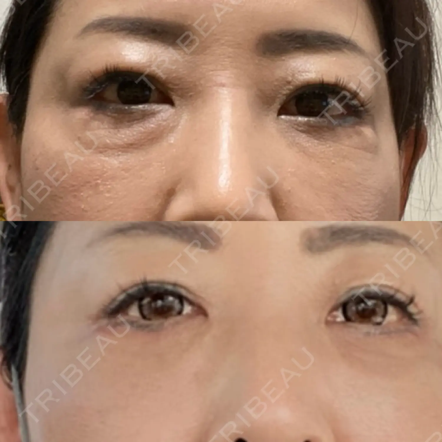 施術後の写真