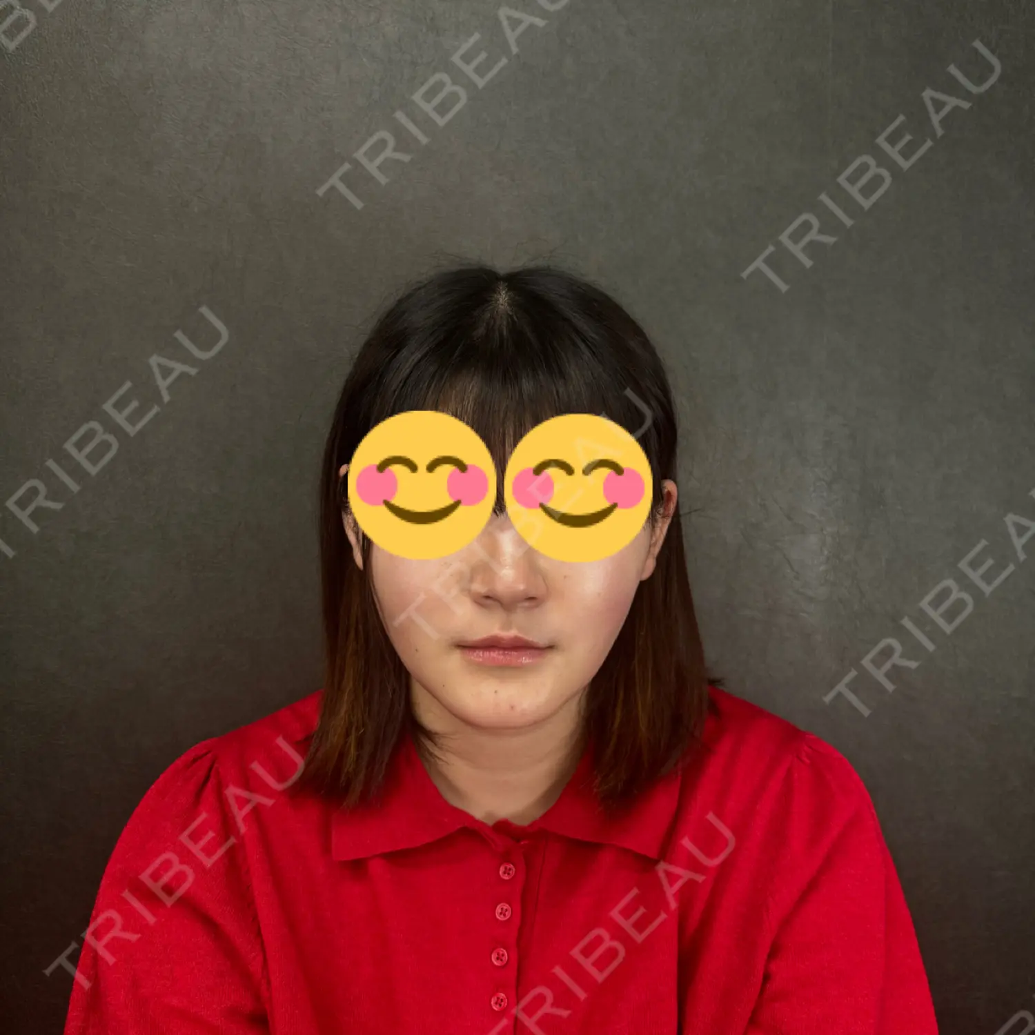 施術後の写真