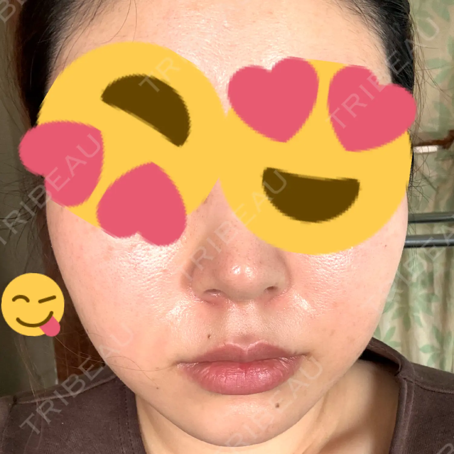 施術後の写真
