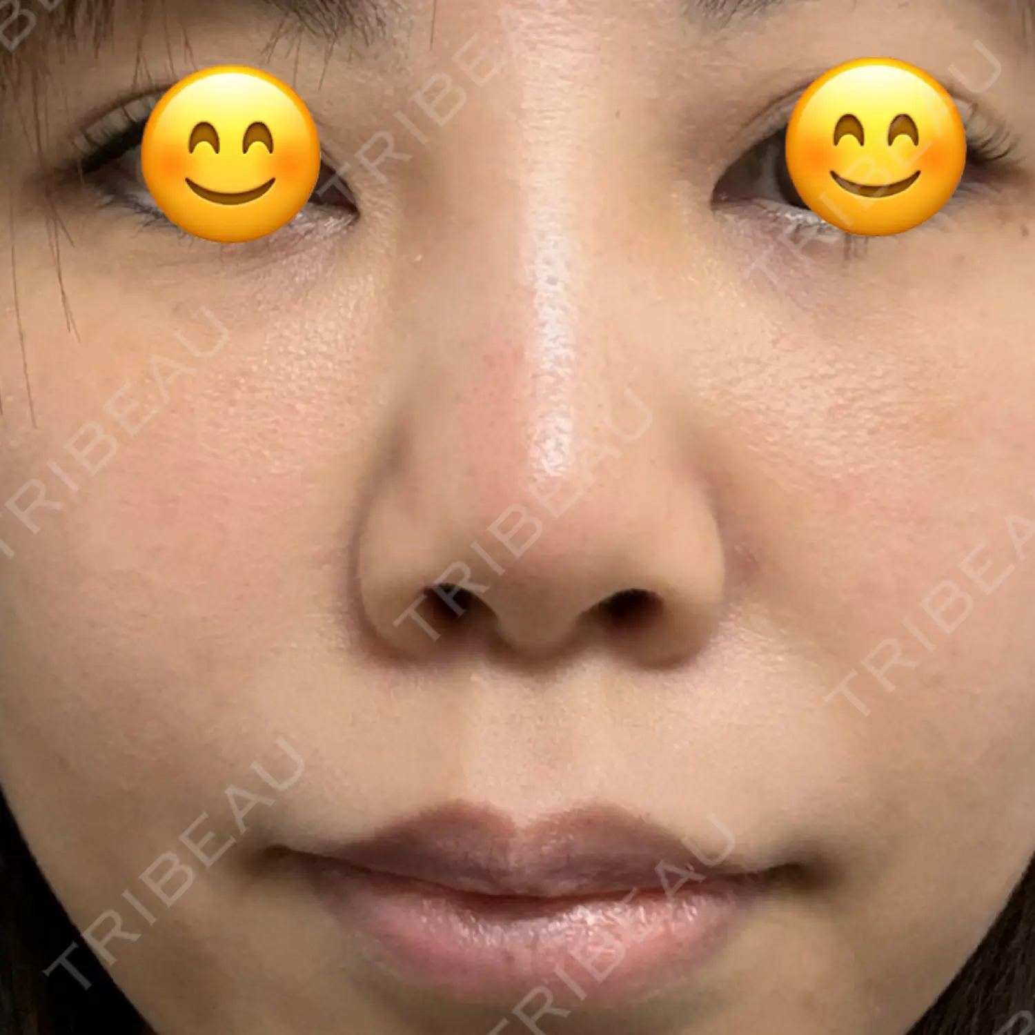 施術後の写真