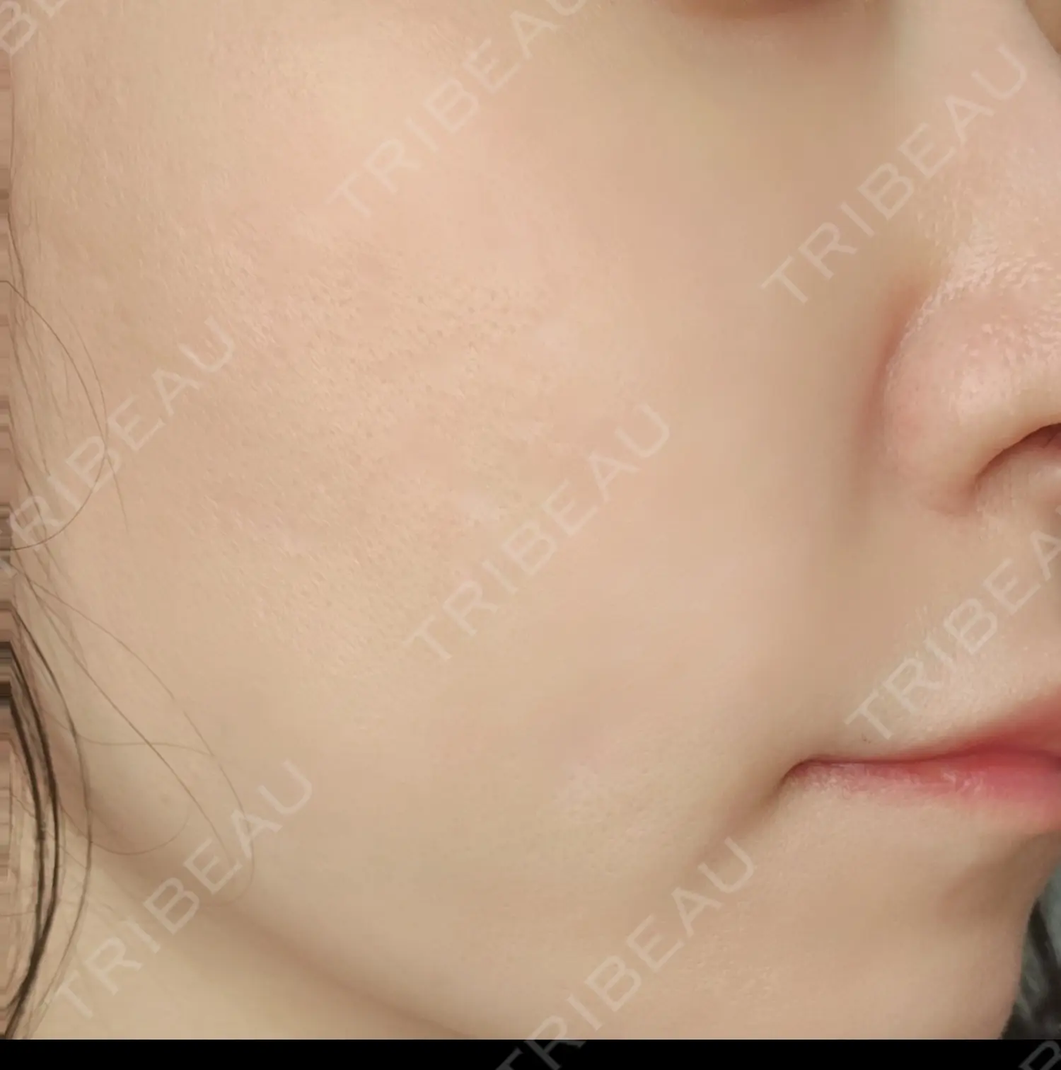 施術後の写真