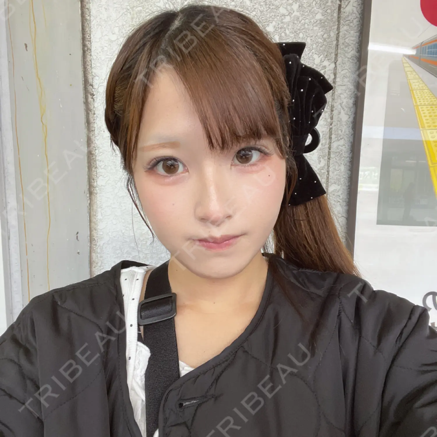 施術後の写真