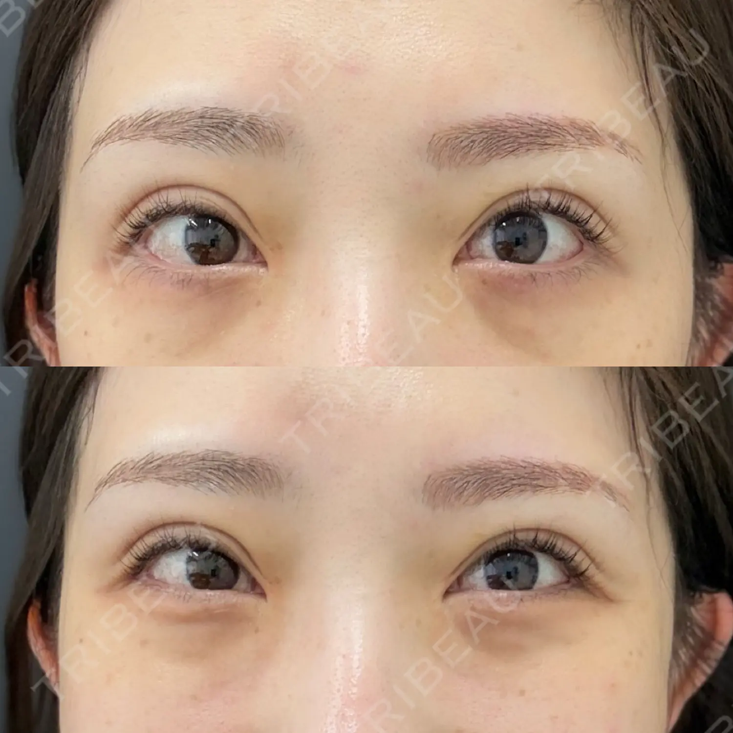 施術後の写真