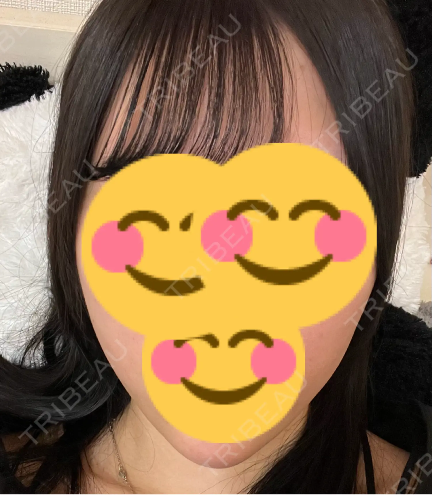 施術後の写真