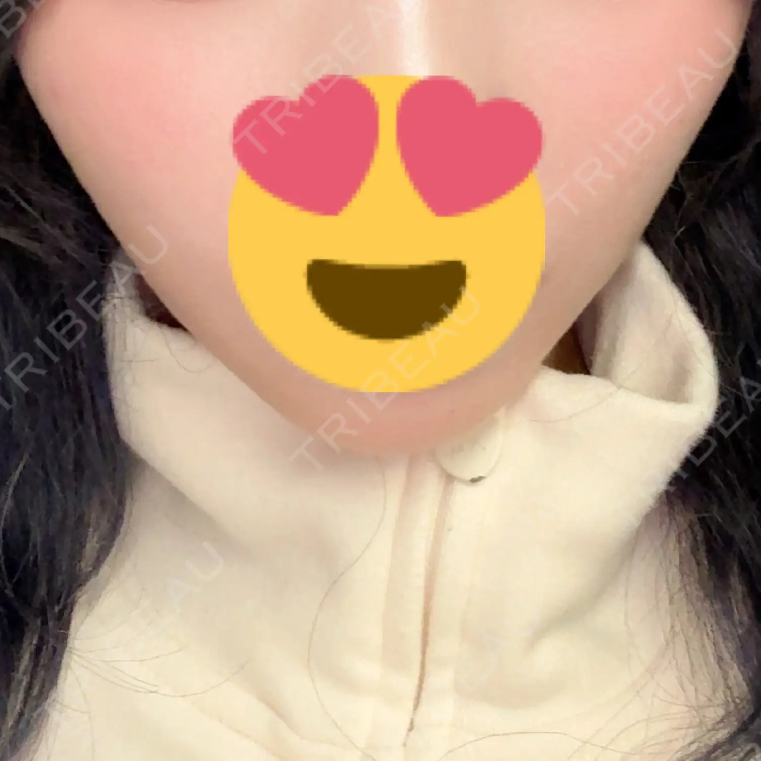 施術後の写真