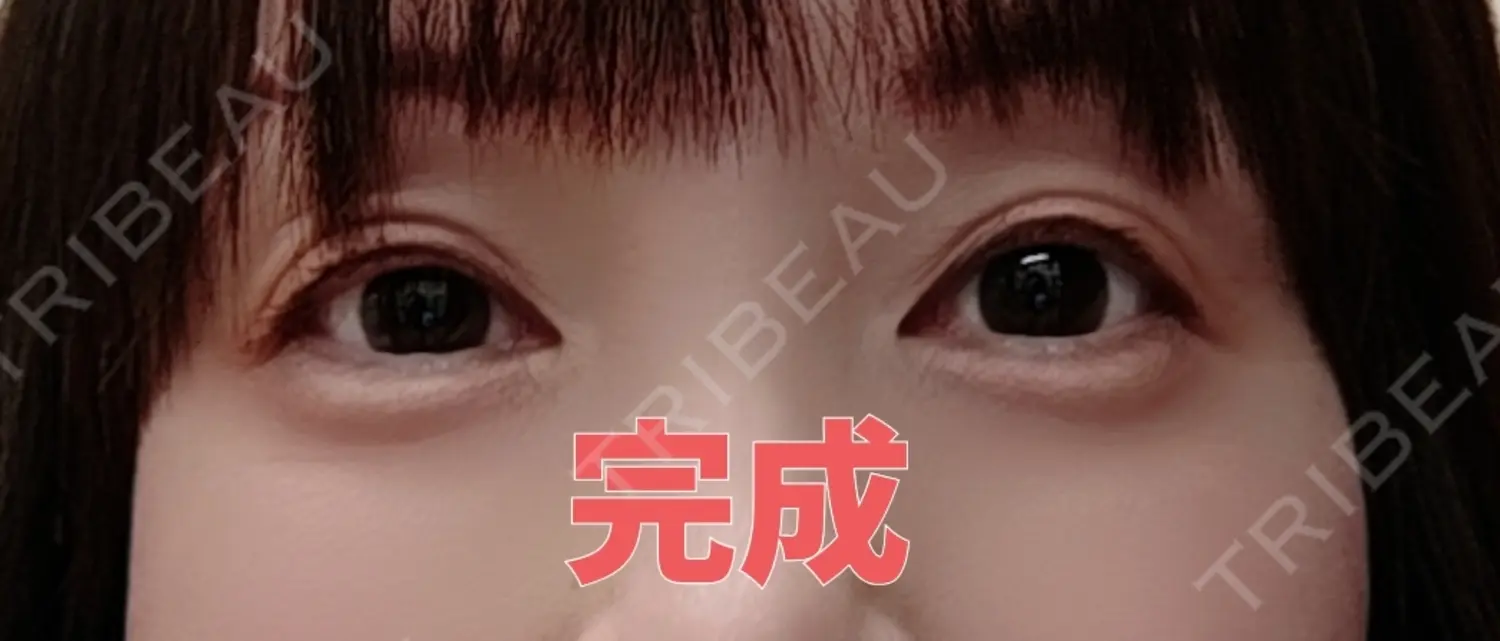 施術後の写真