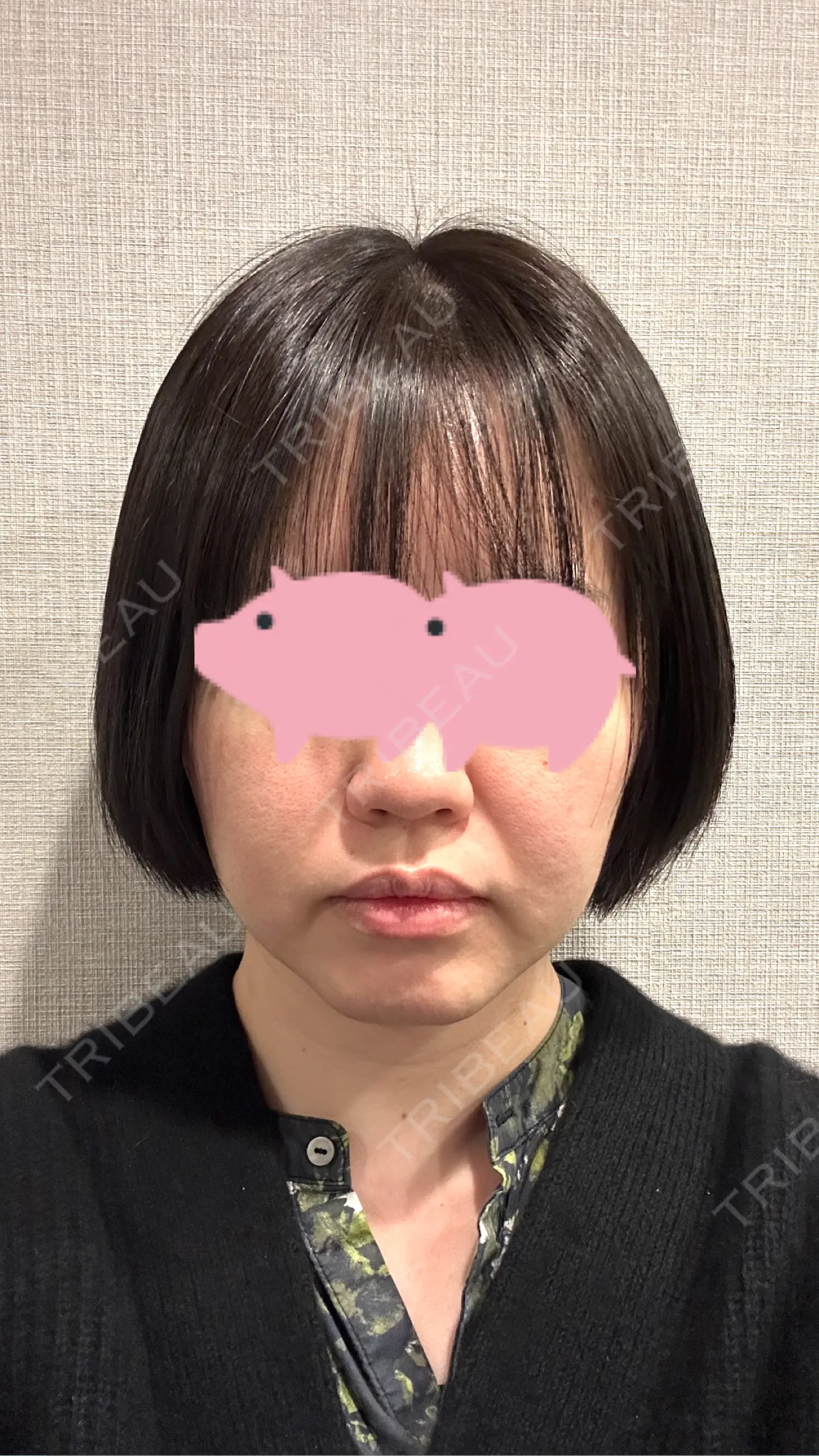 施術後の写真