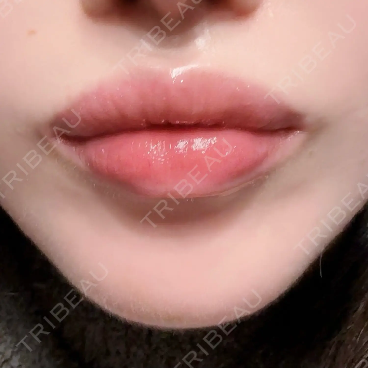 施術後の写真