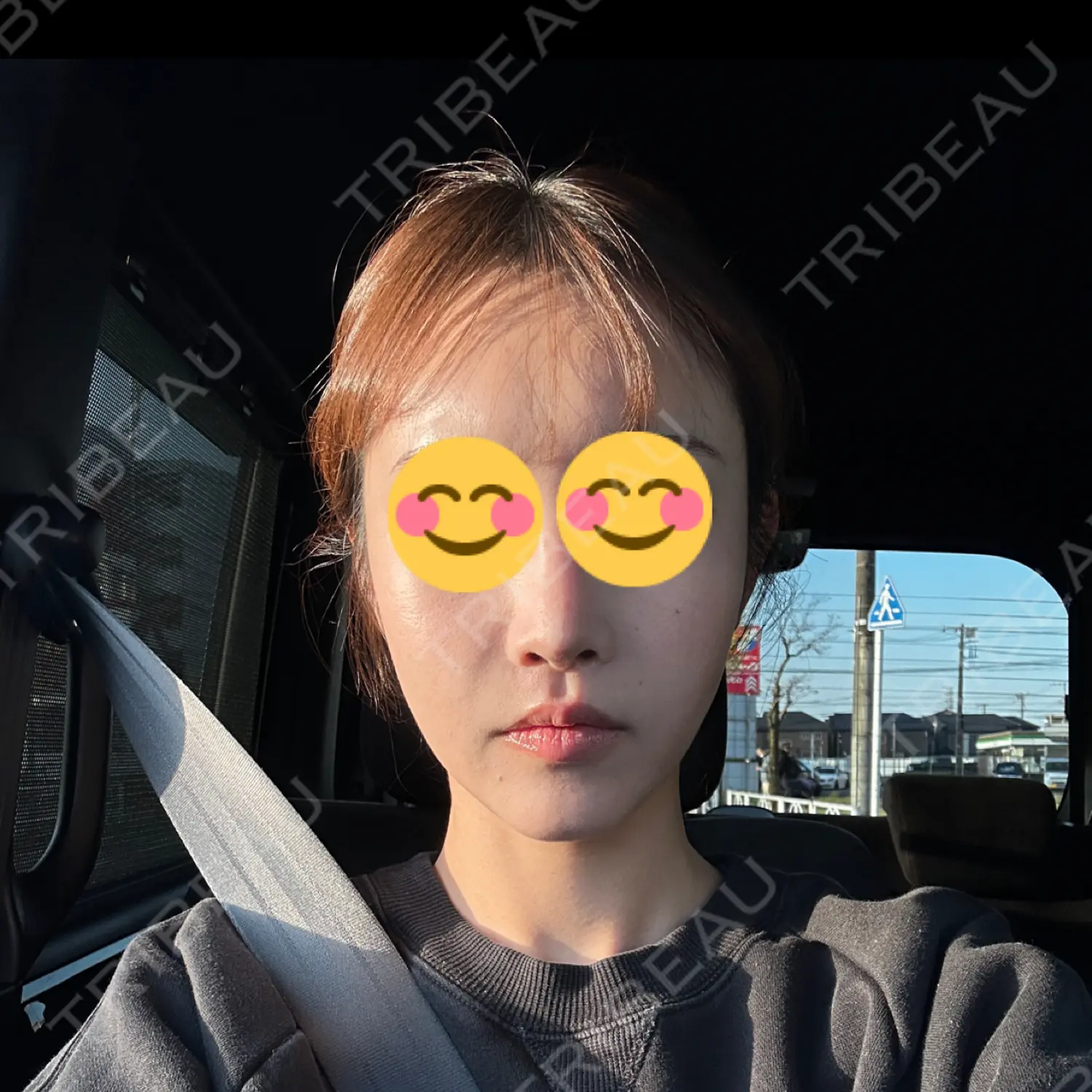 施術後の写真