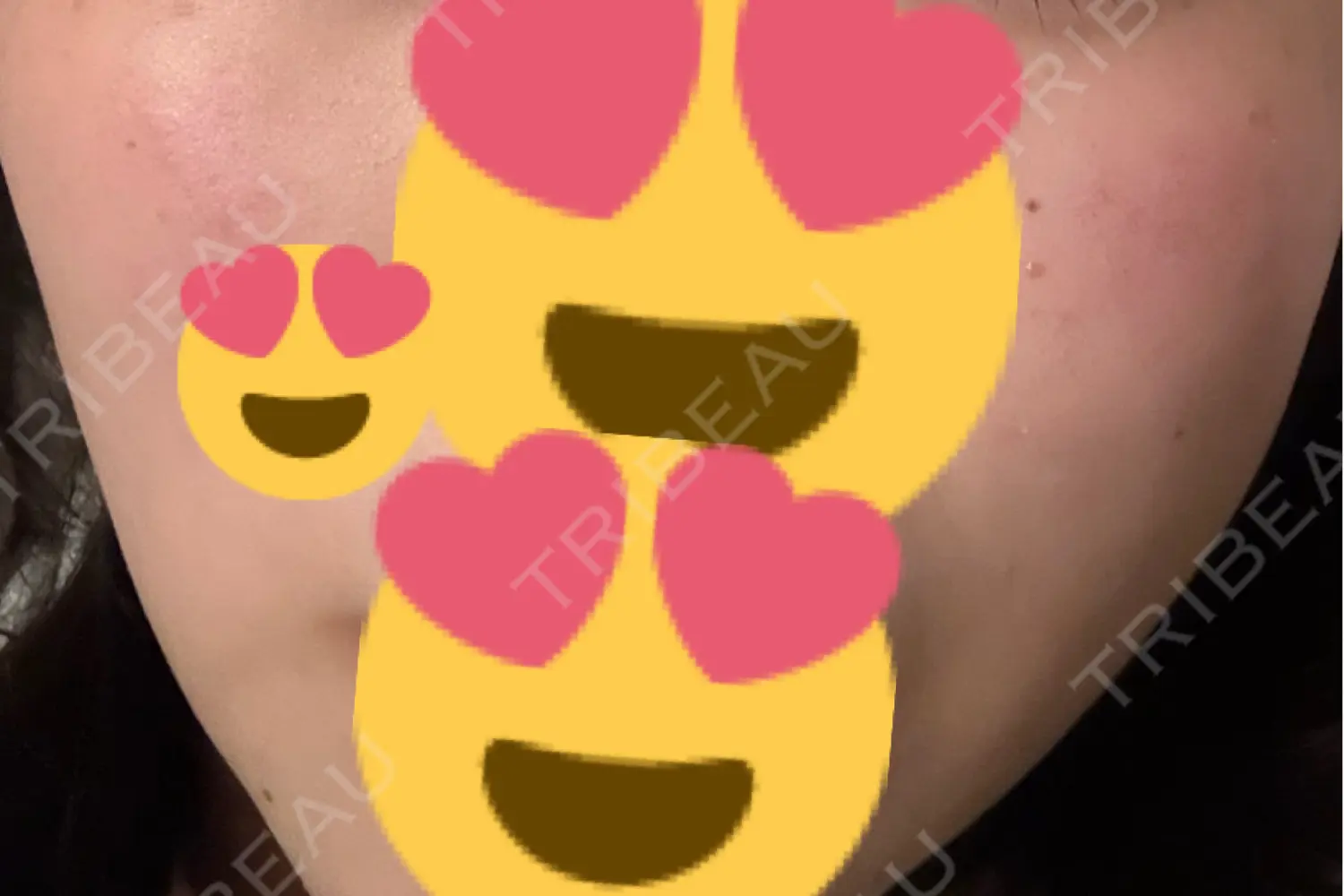 施術後の写真