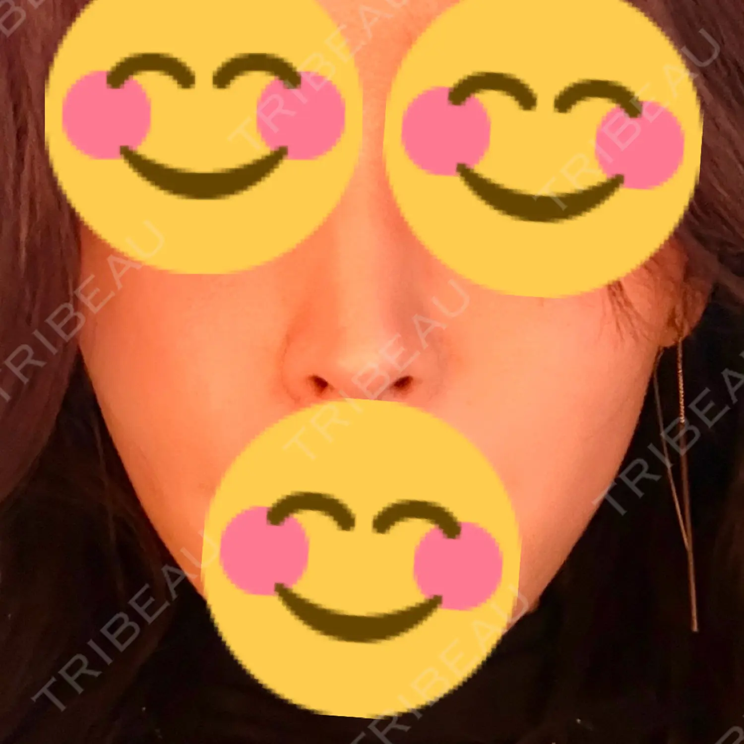 施術後の写真