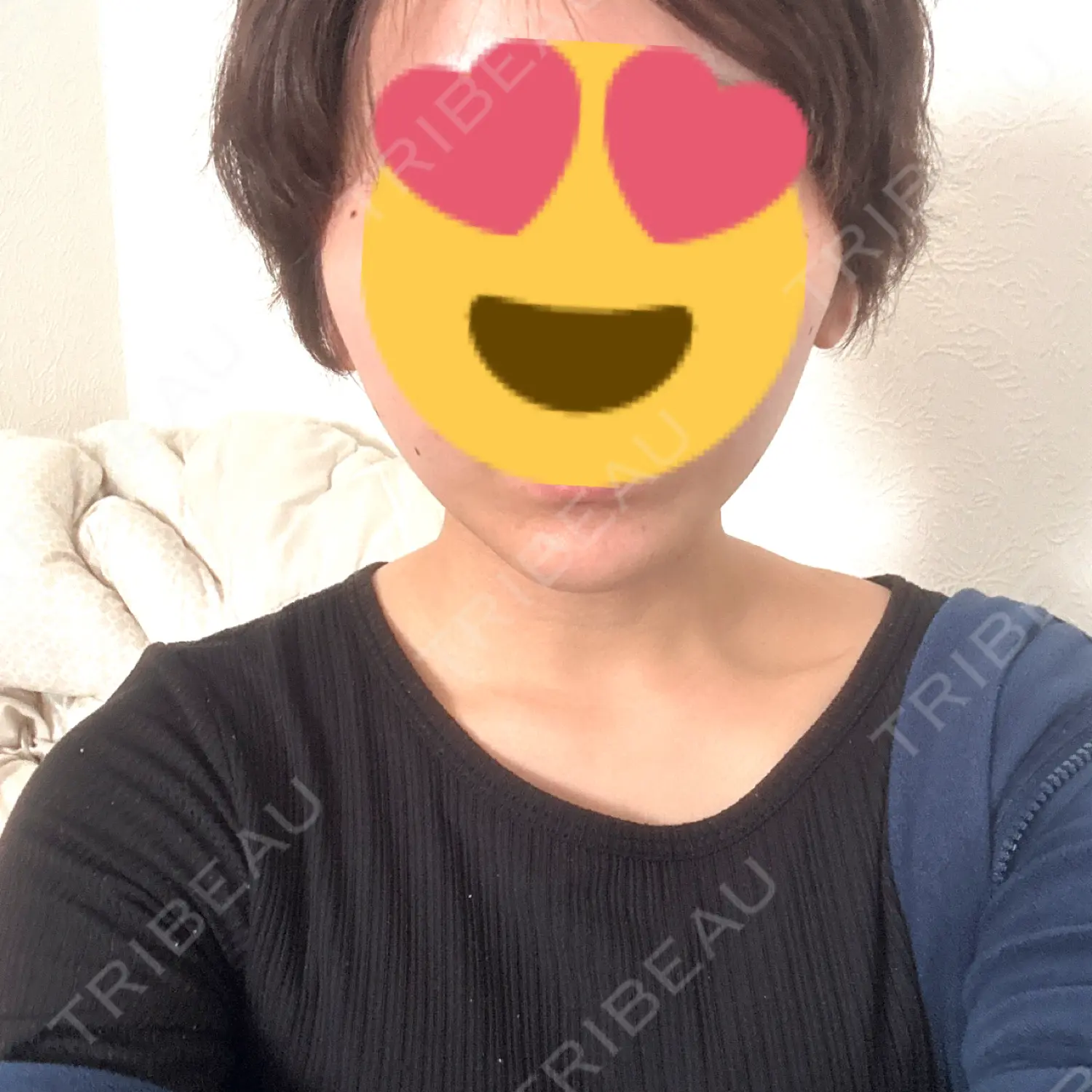 施術後の写真