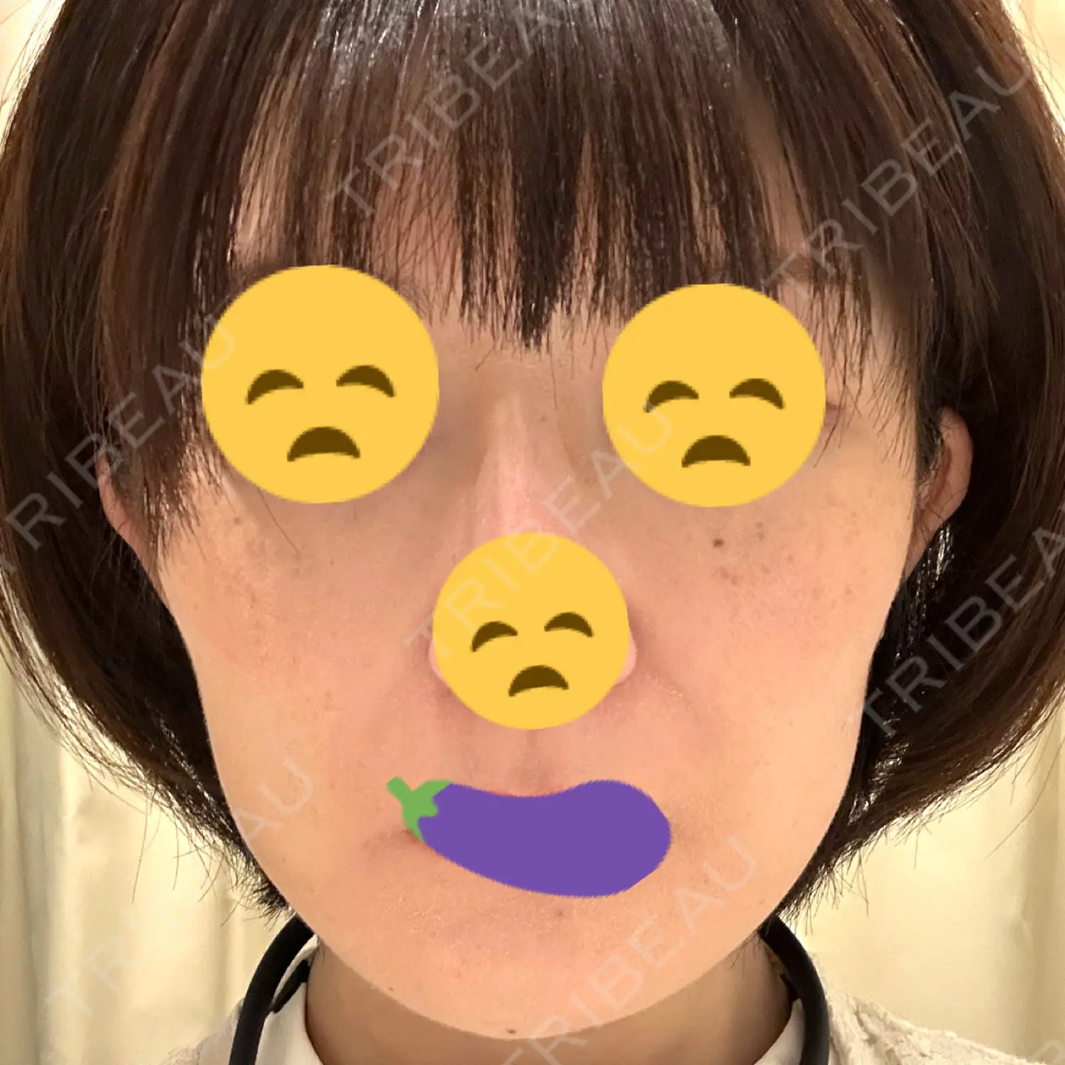 施術後の写真