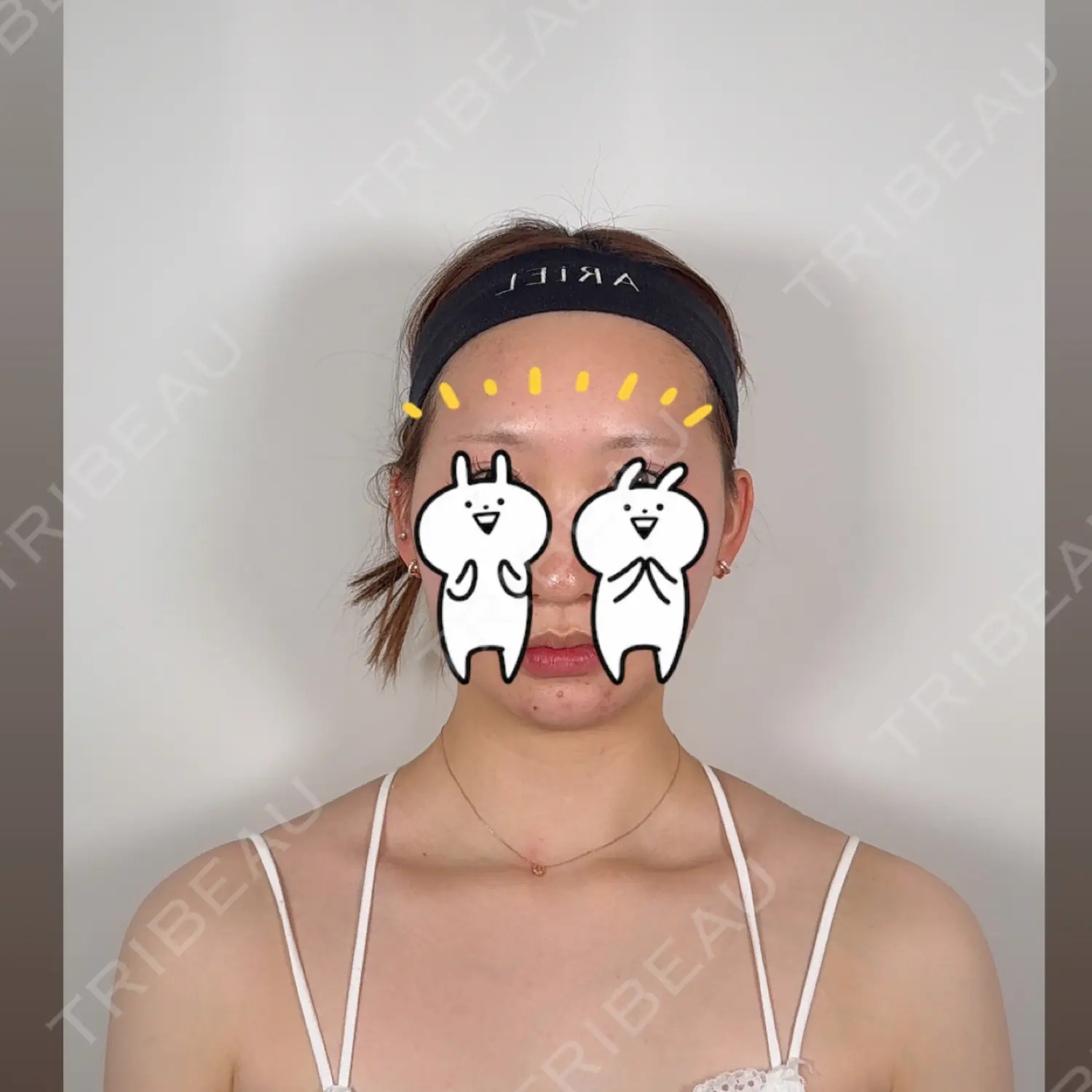 施術後の写真