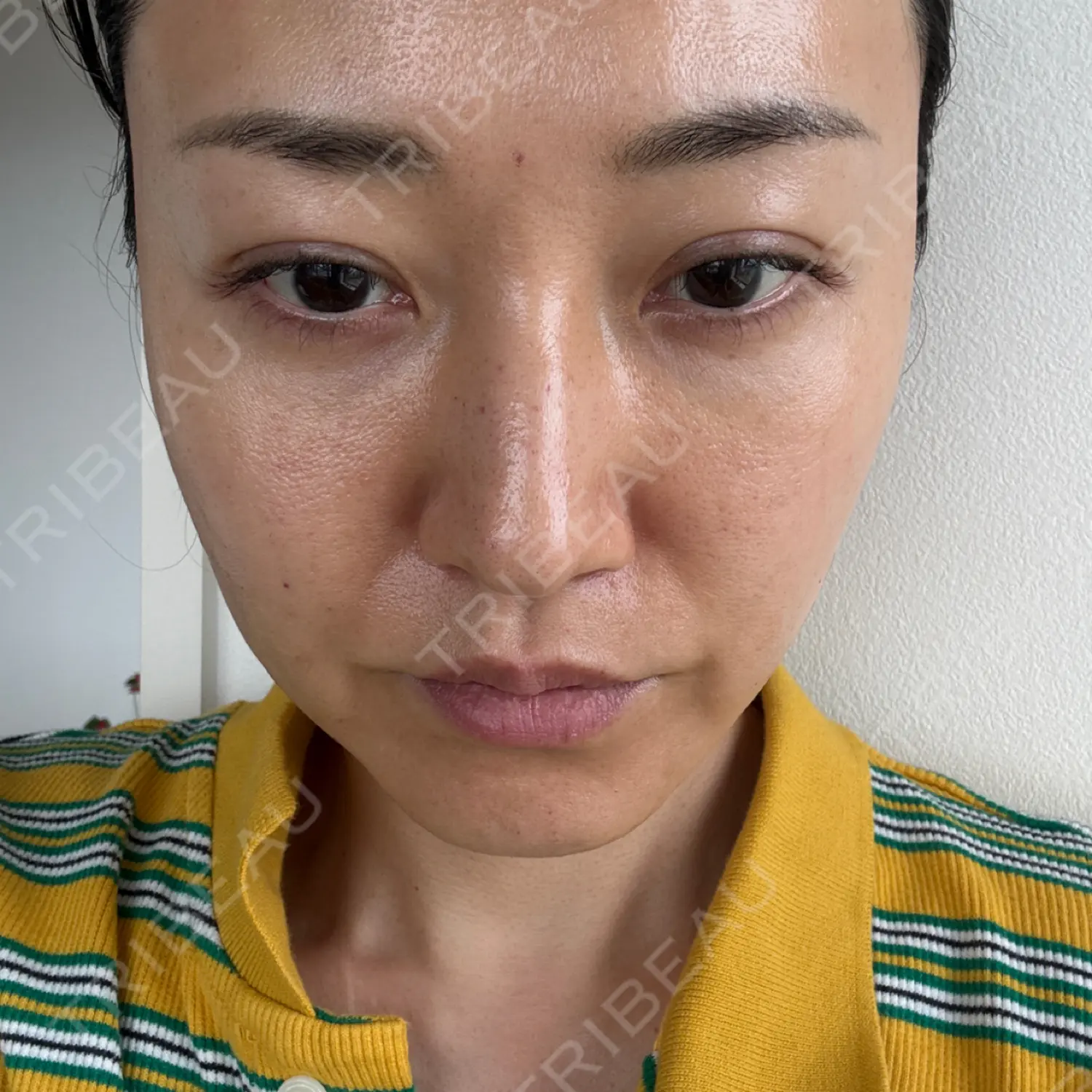 施術後の写真