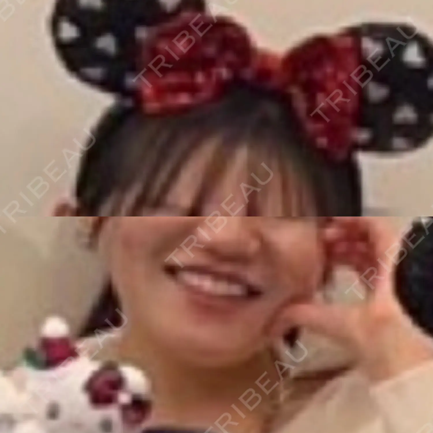 施術後の写真