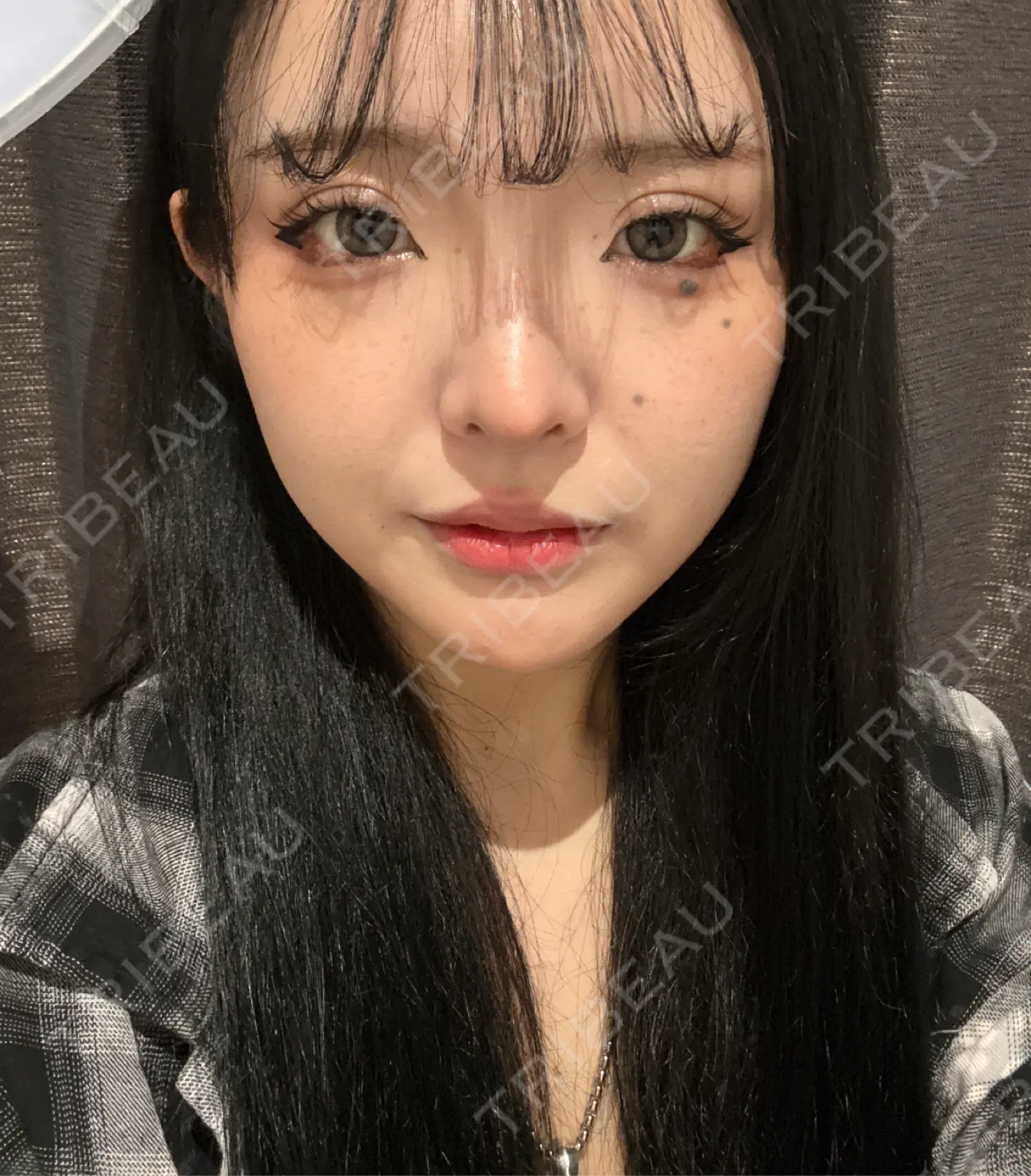 施術後の写真