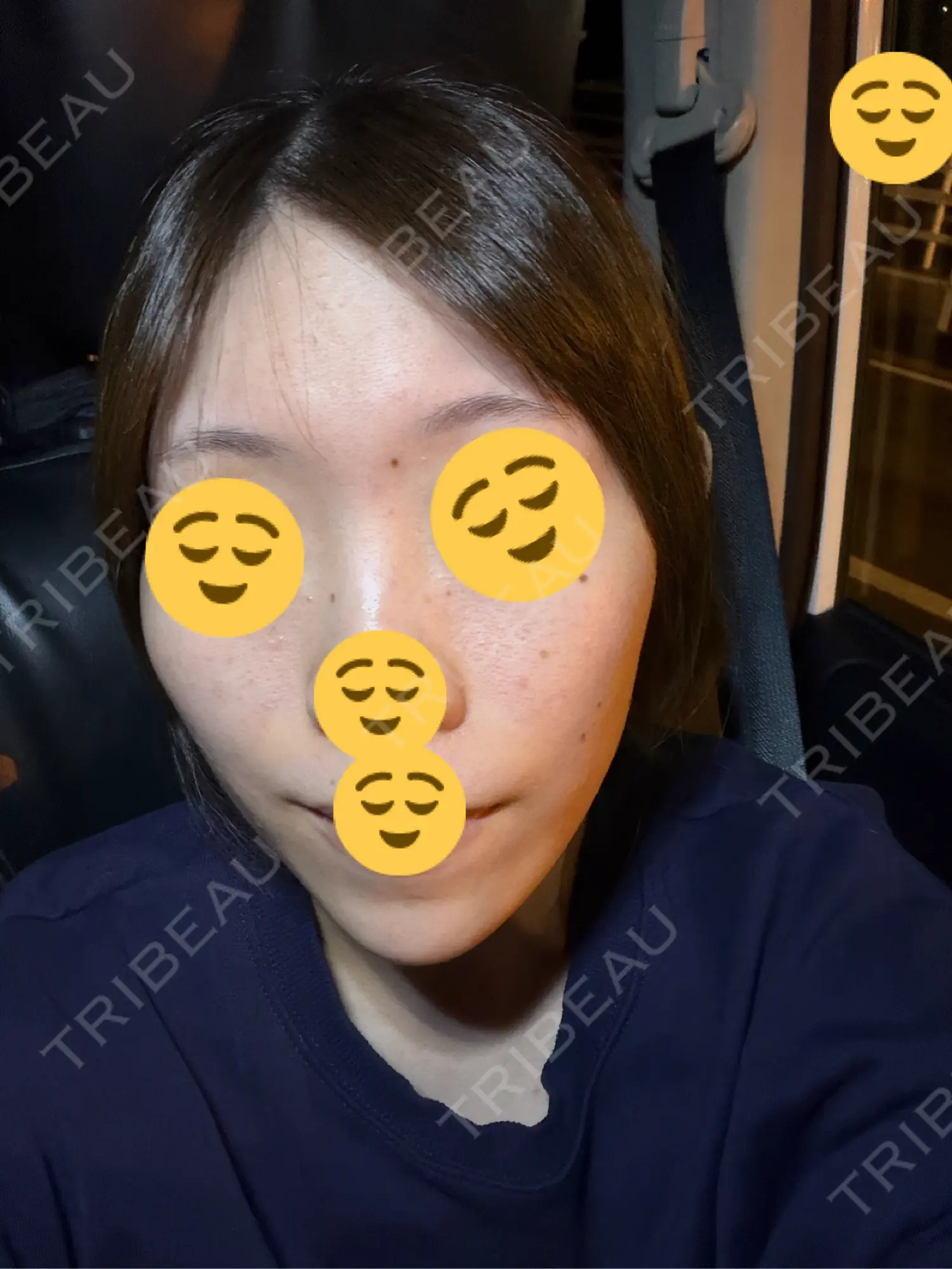 施術後の写真