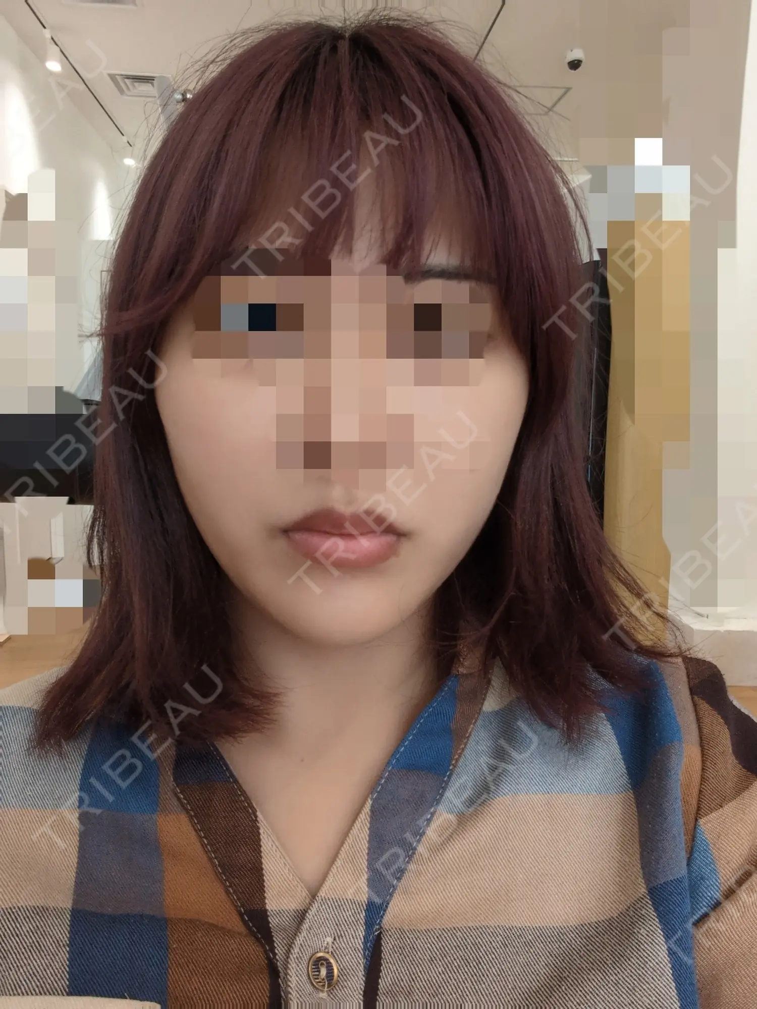 施術後の写真