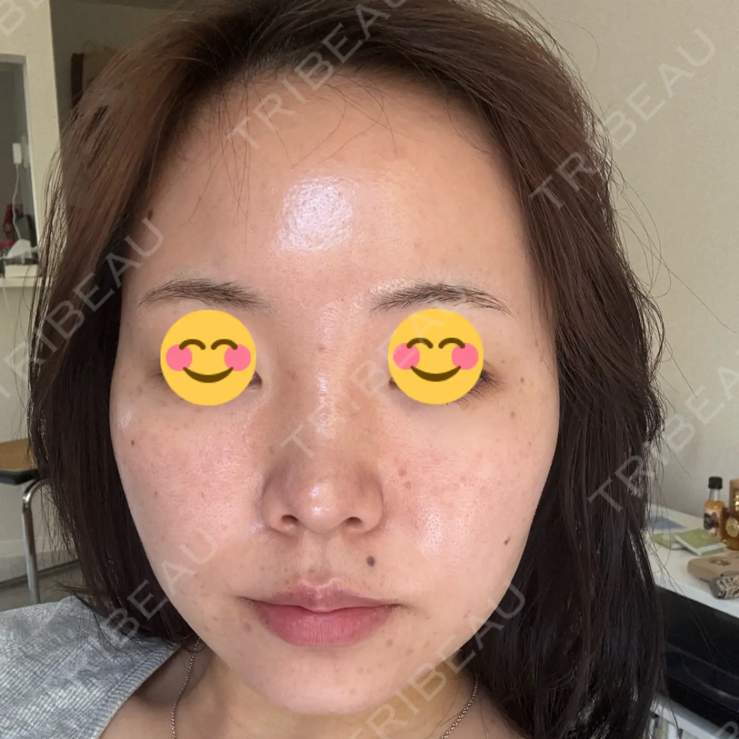 施術後の写真