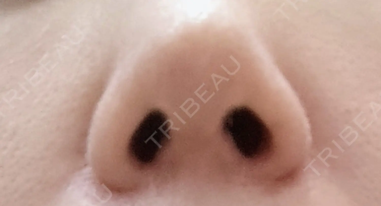 施術後の写真