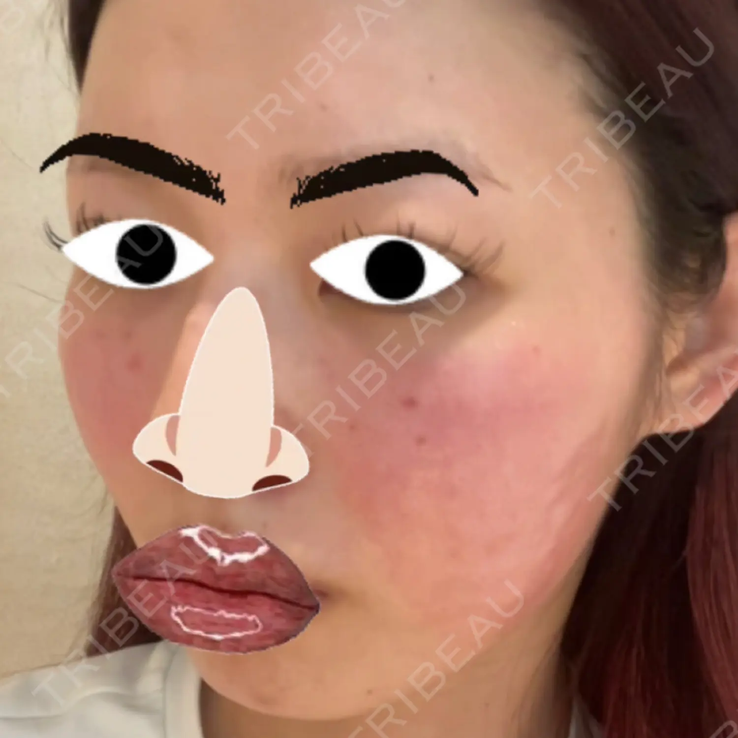 施術後の写真