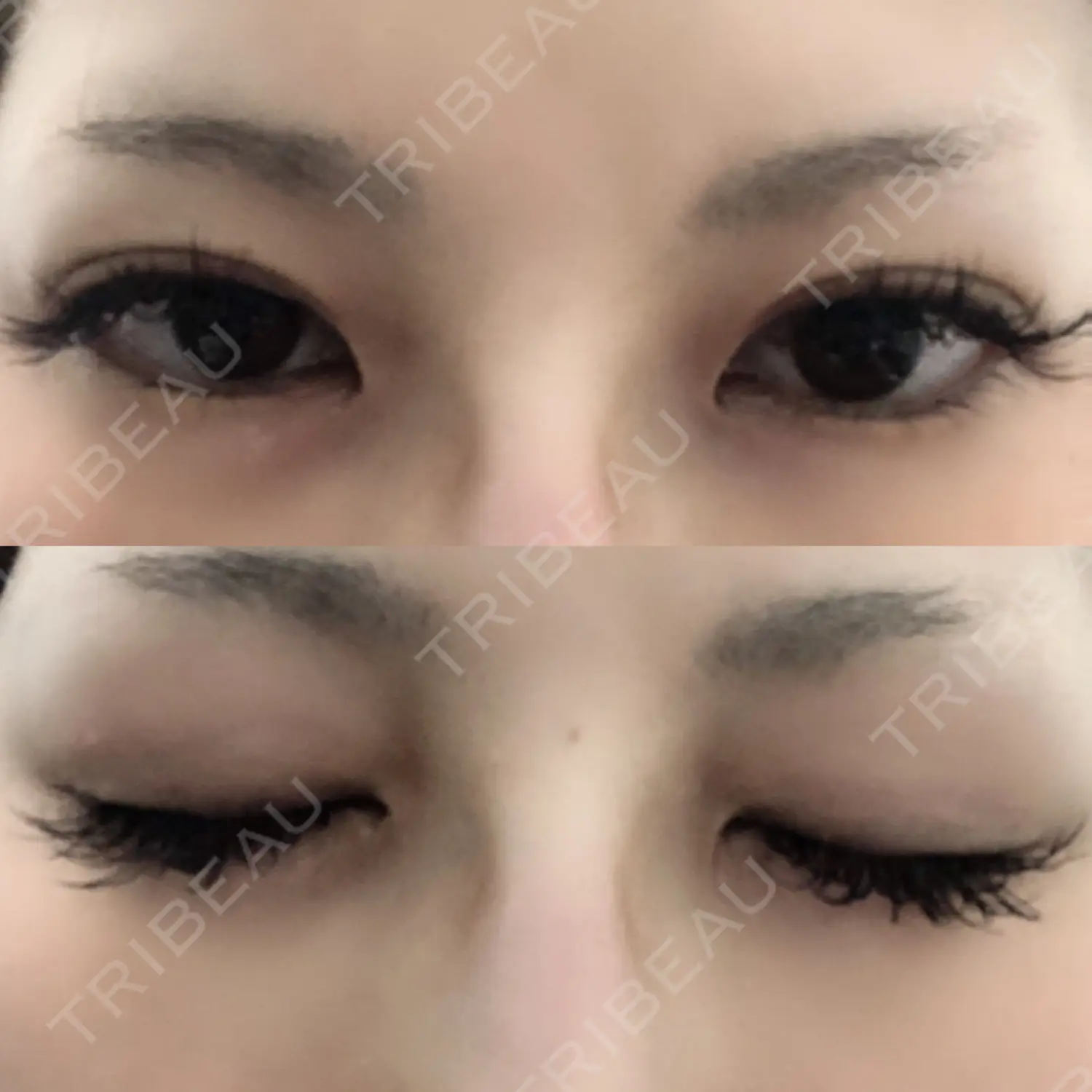 施術後の写真