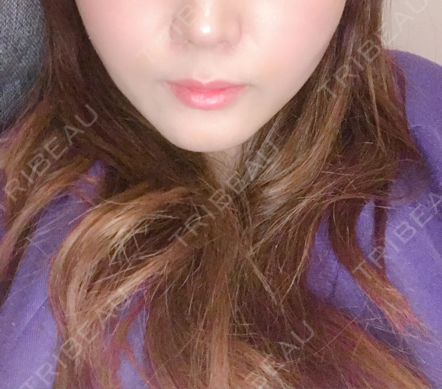 施術後の写真