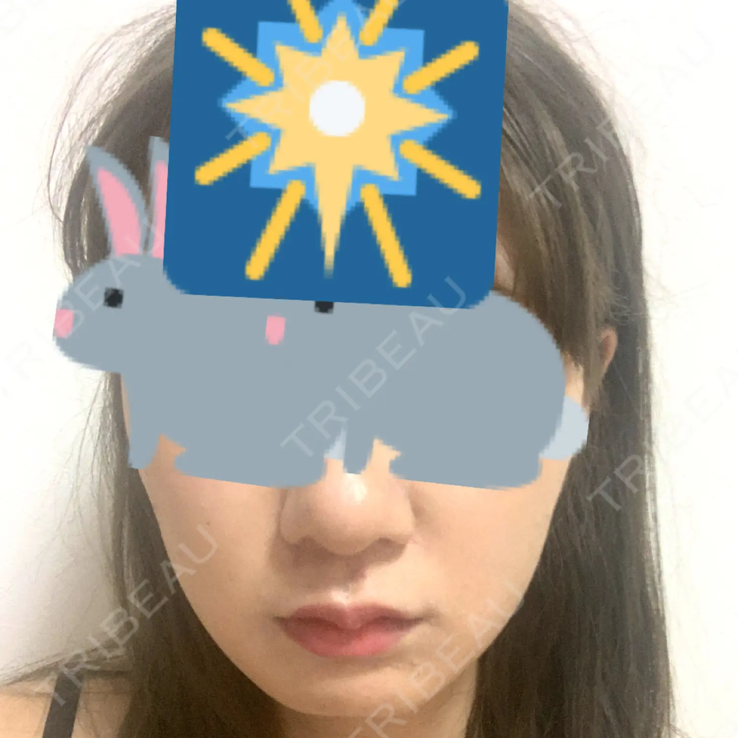 施術後の写真