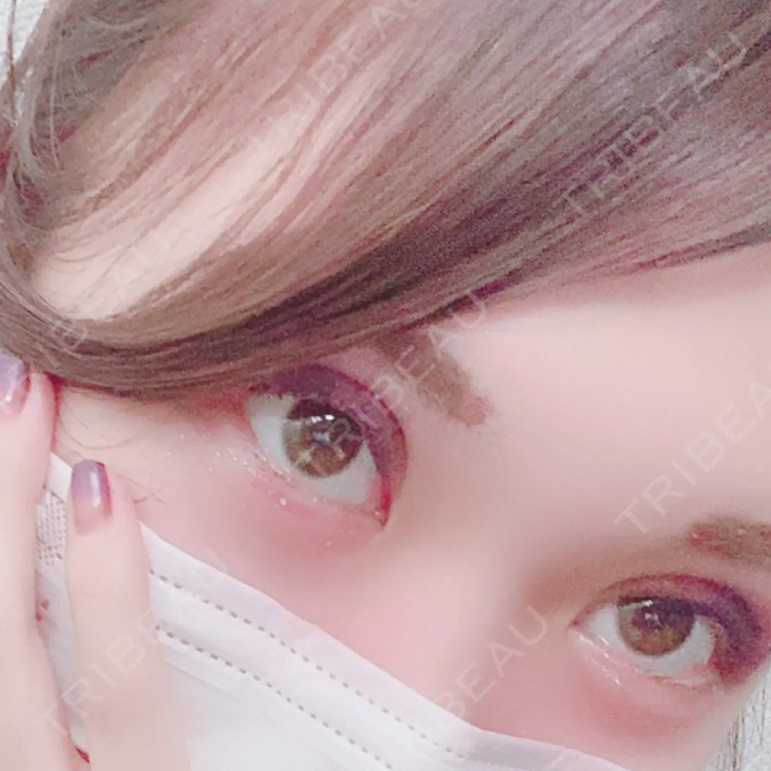 施術後の写真