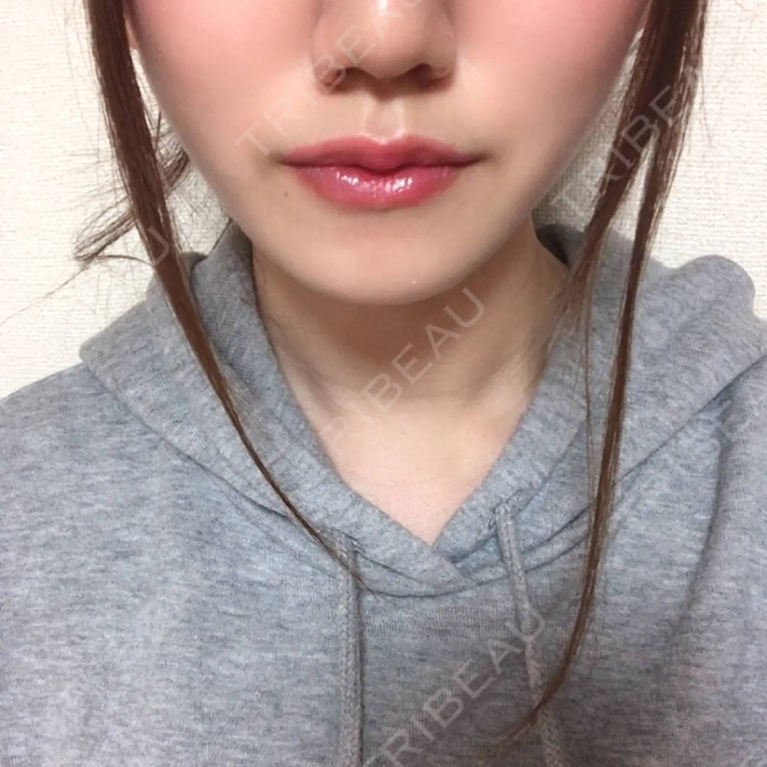 施術後の写真