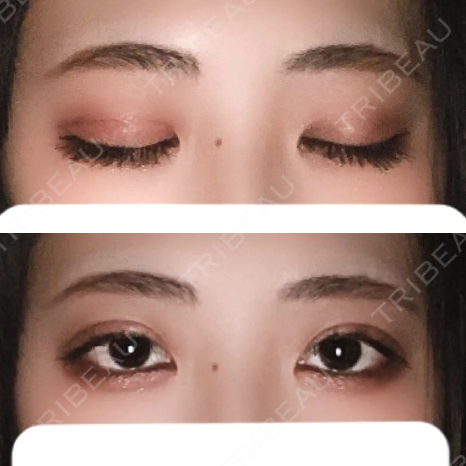 施術後の写真