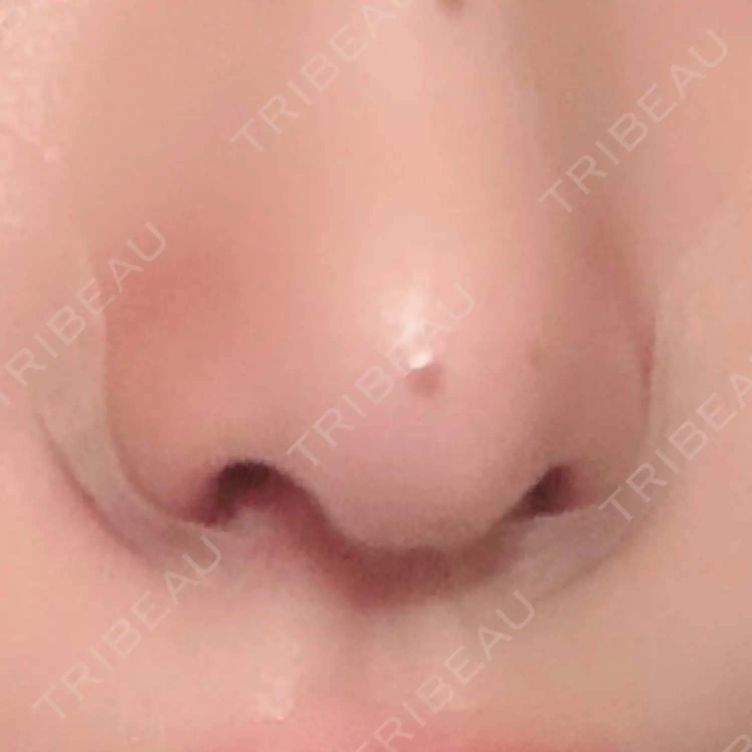 施術後の写真