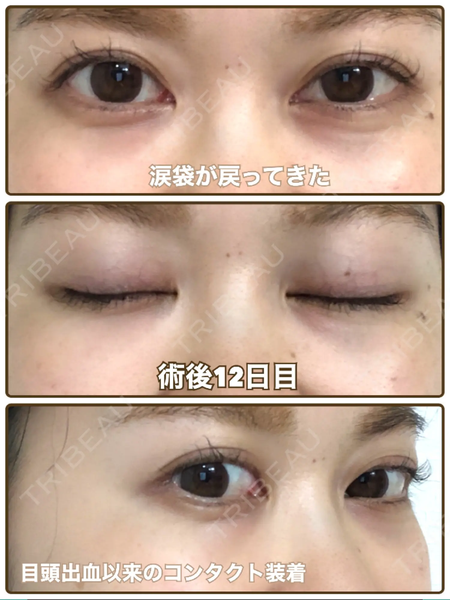 施術後の写真