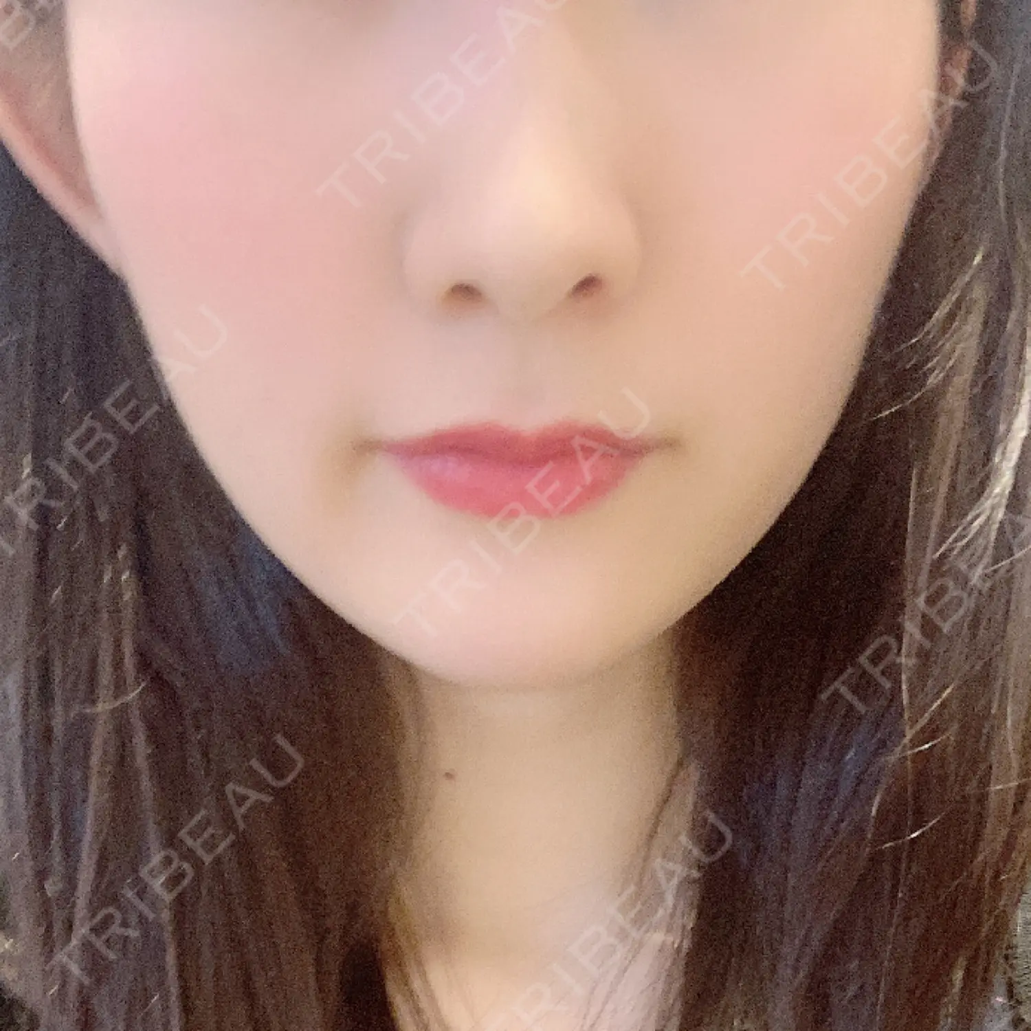 施術後の写真