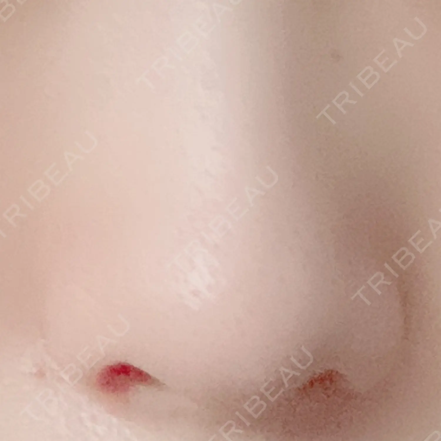 施術後の写真