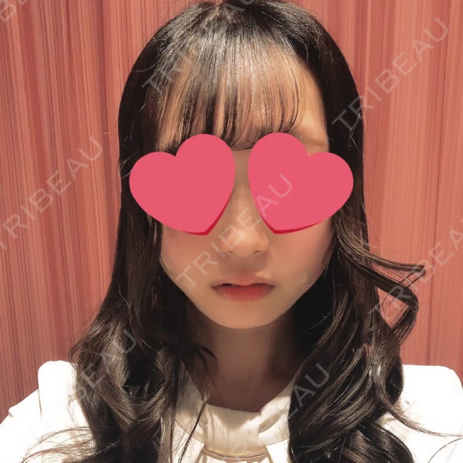 施術後の写真