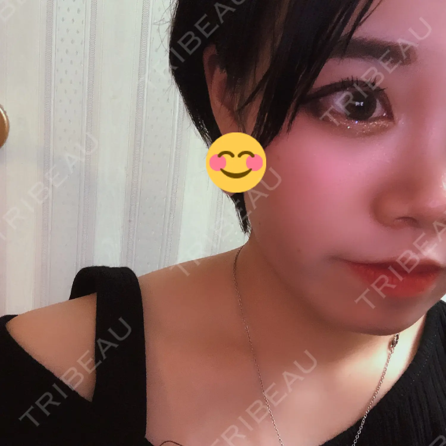 施術後の写真