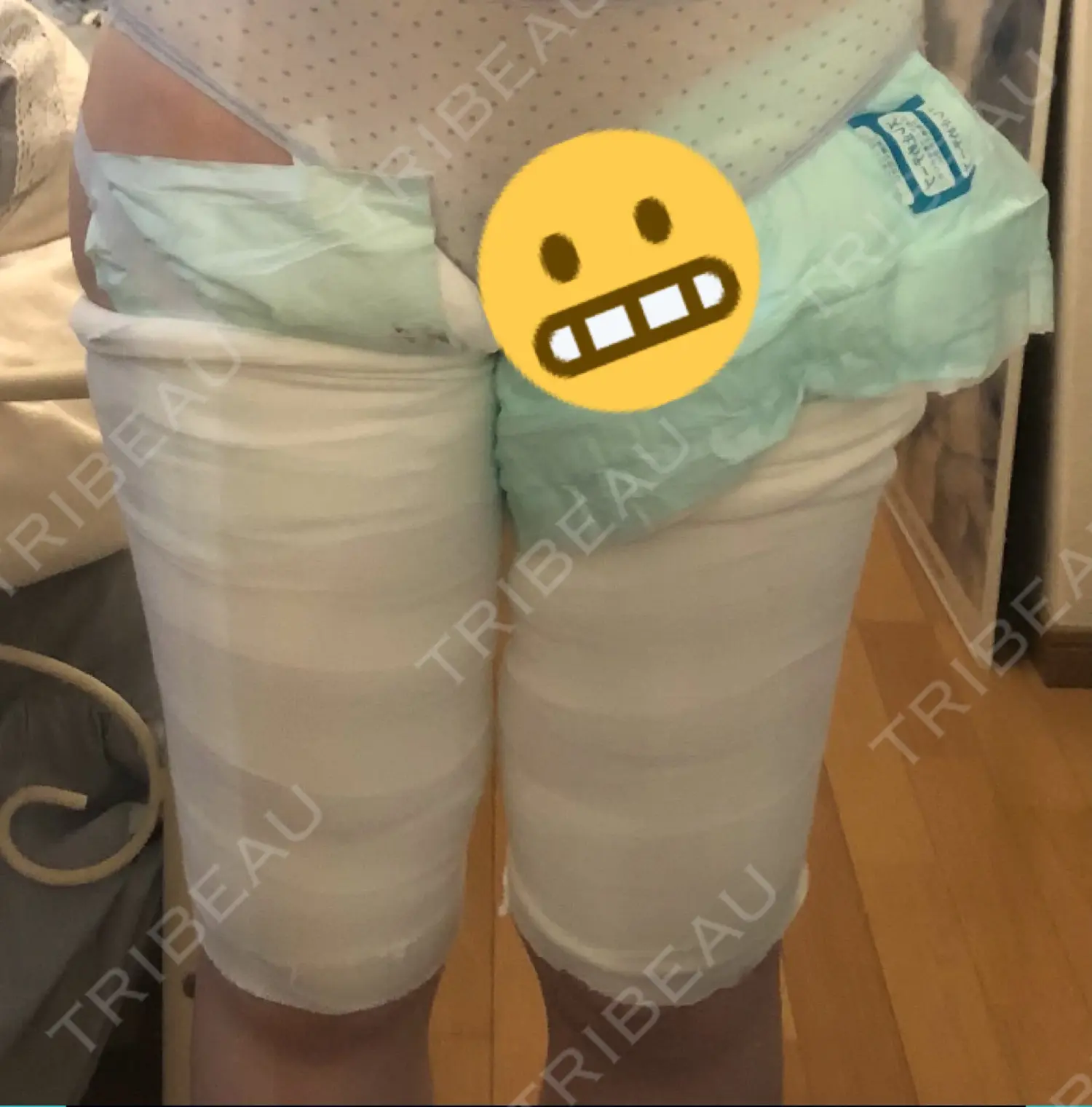 施術後の写真