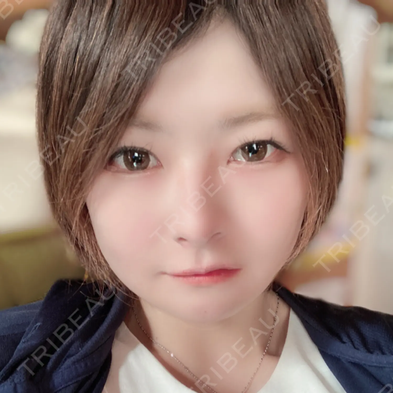 施術後の写真