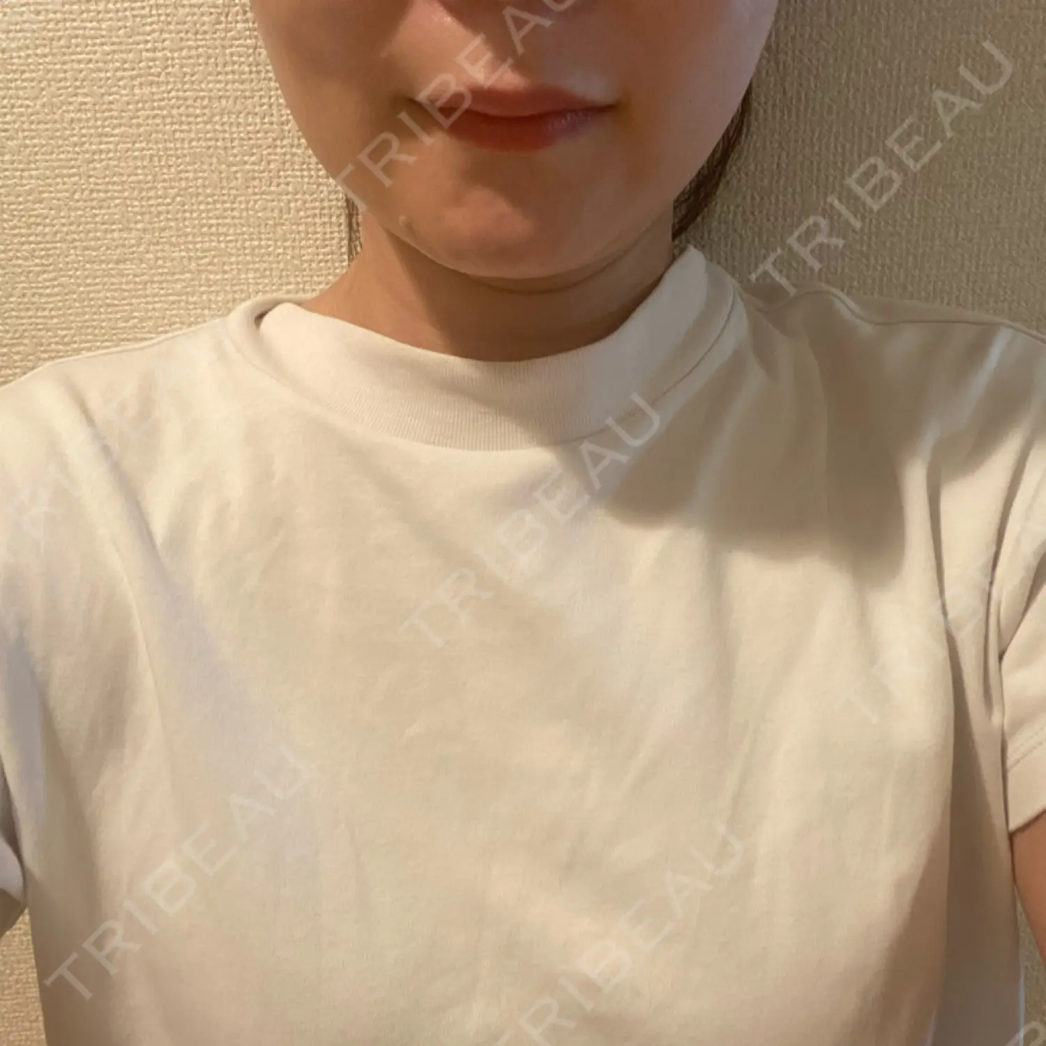 施術後の写真