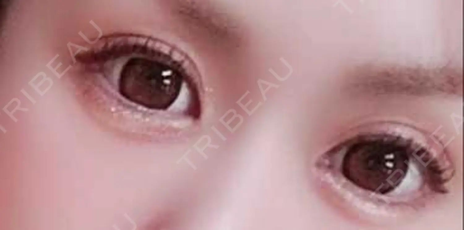 施術後の写真
