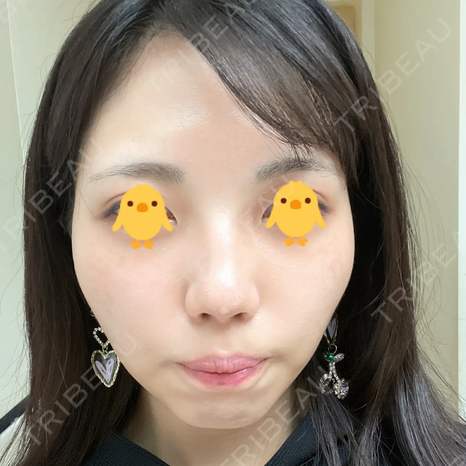 施術後の写真
