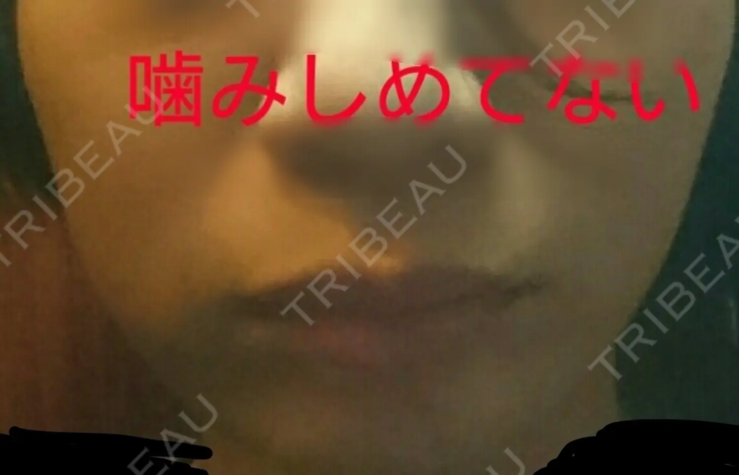 施術後の写真
