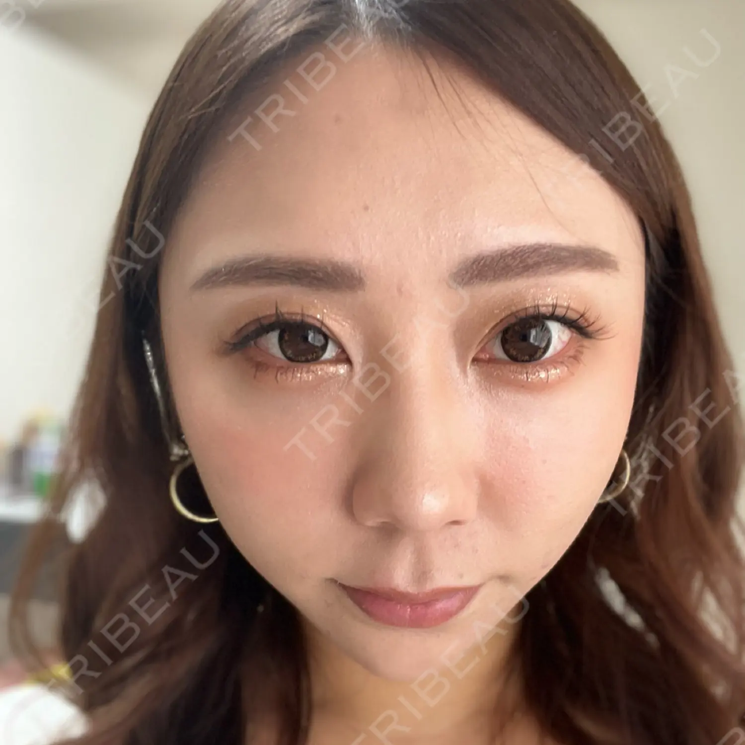 施術後の写真